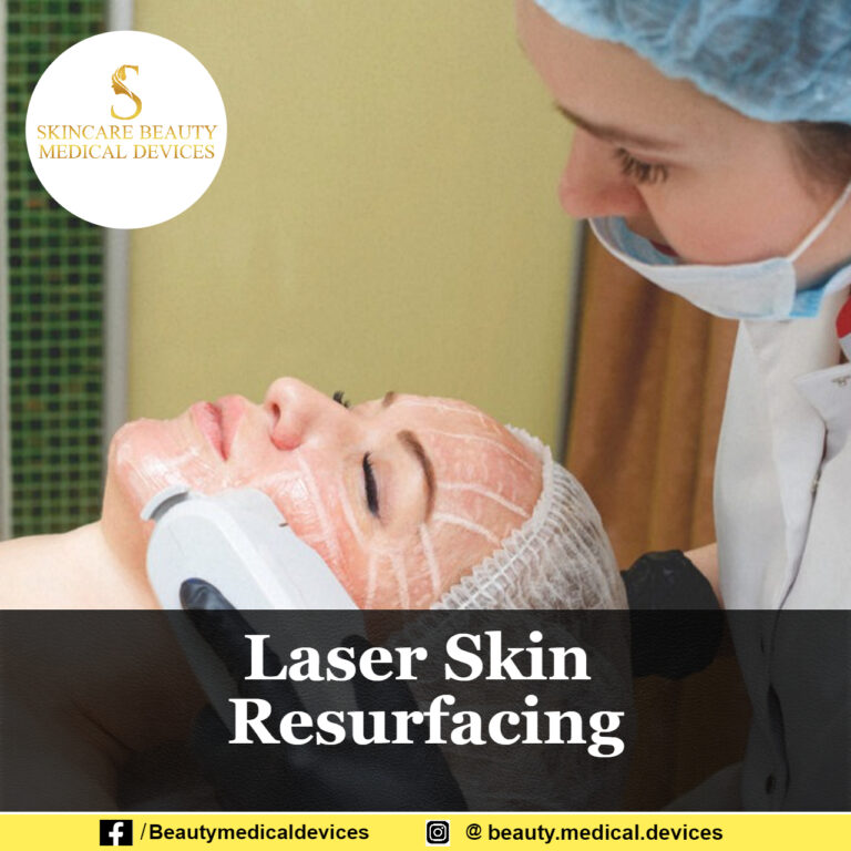 Laser Skin Resurfacing