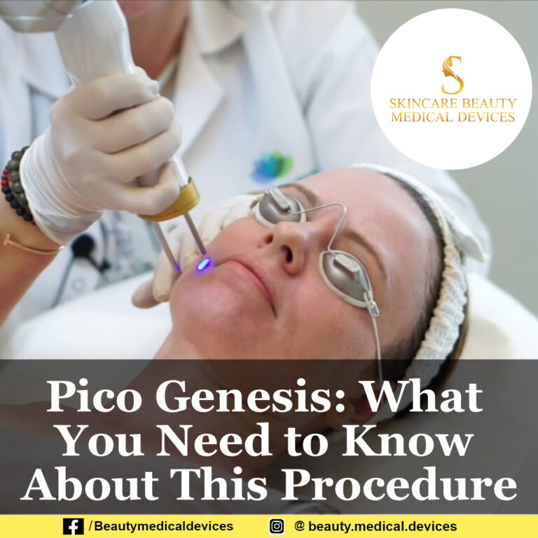 Pico Genesis: What You Need to Know About This Procedure