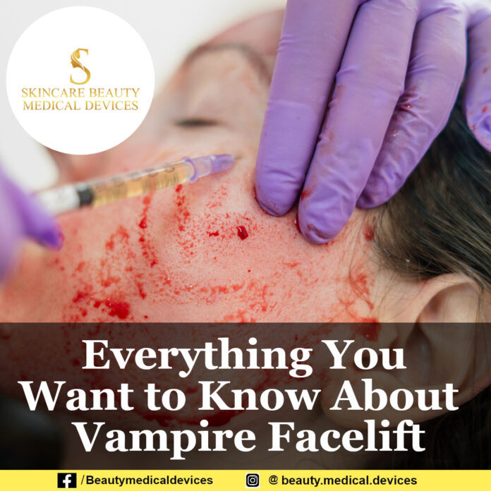 Everything You Want to Know About Vampire Facelift