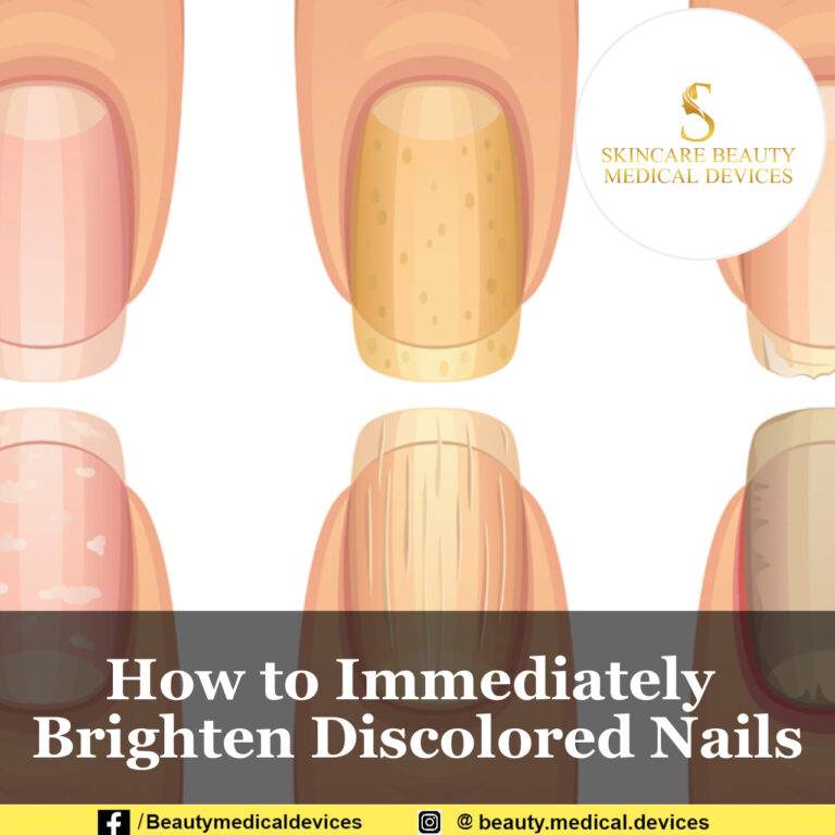 How to Immediately Brighten Discolored Nails