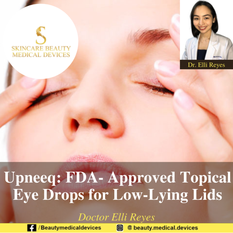 Upneeq: FDA- Approved Topical Eye Drops for Low-Lying Lids