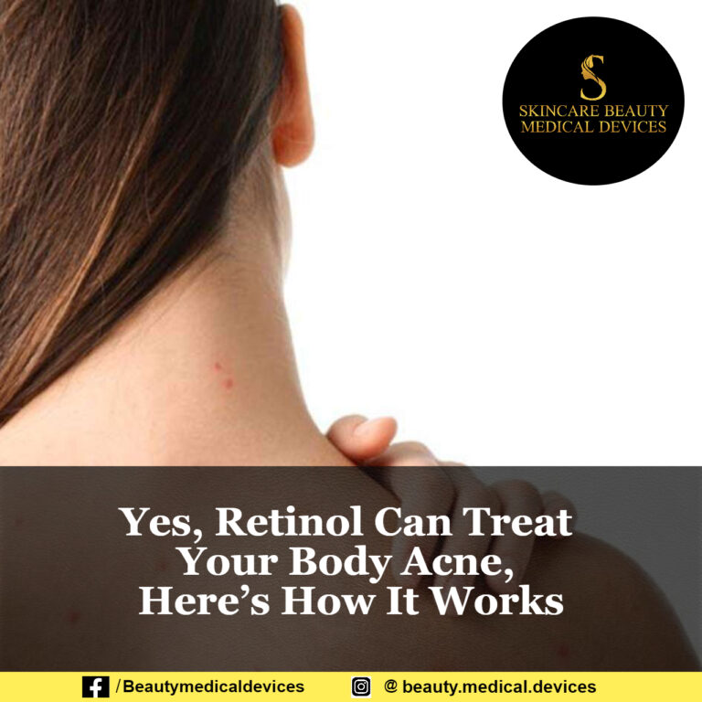 Yes, Retinol Can Treat Your Body Acne, Here’s How It Works