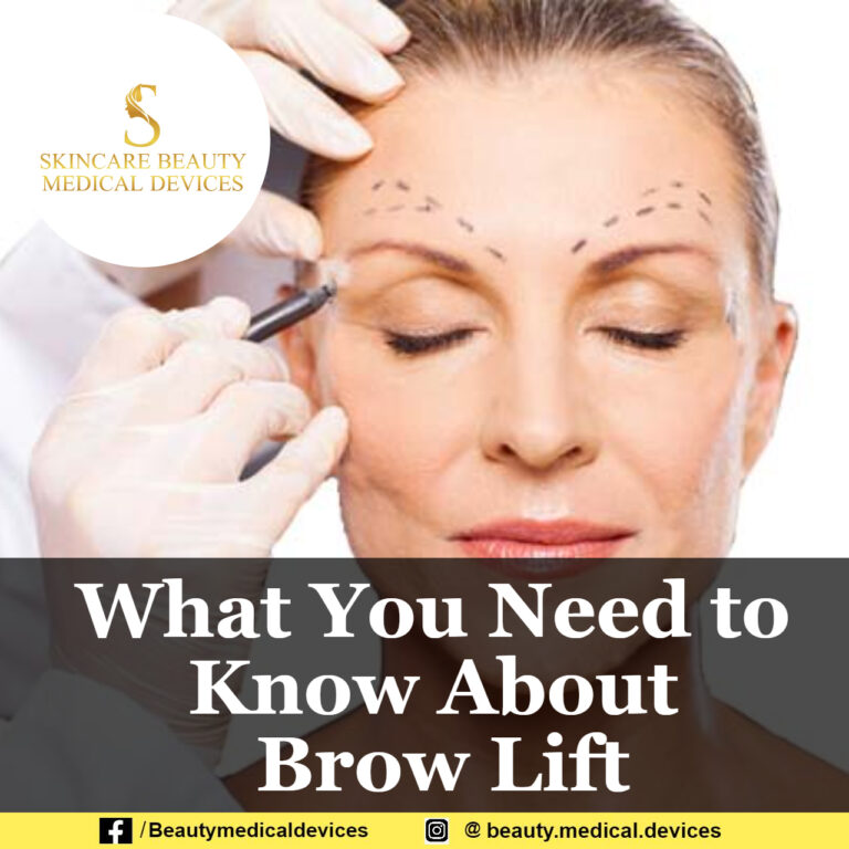 What You Need to Know About Brow Lift