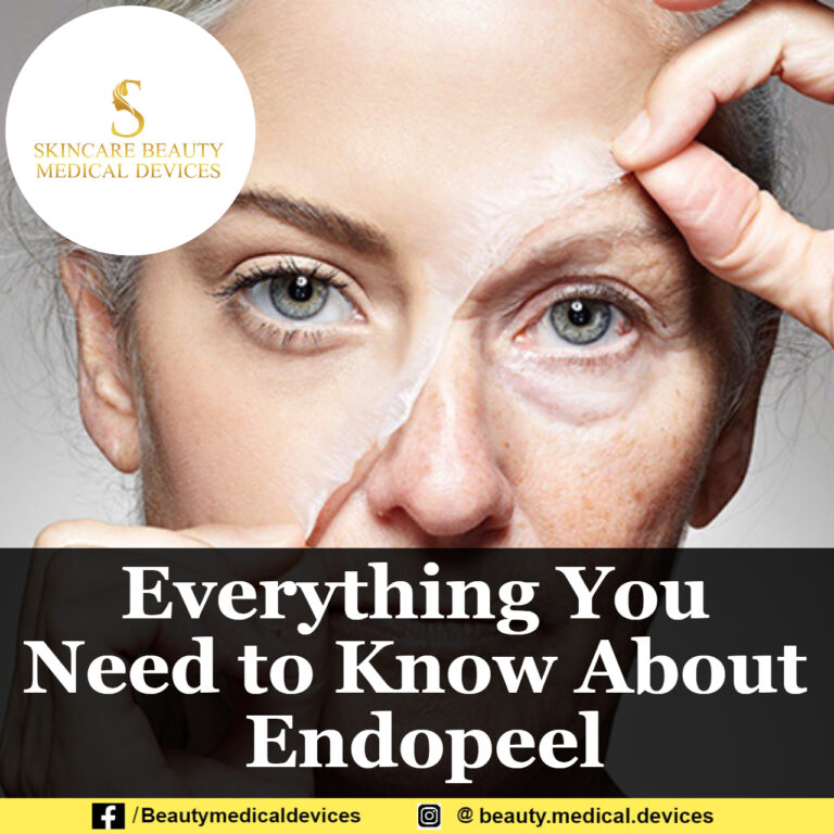 Everything You Need to Know About Endopeel