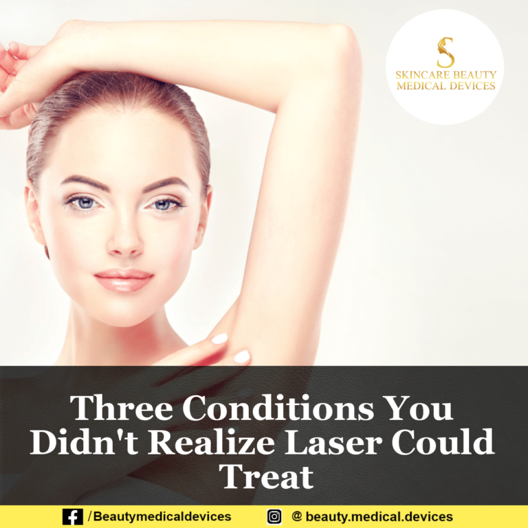 Three Conditions You Didn’t Realize Laser Could Treat