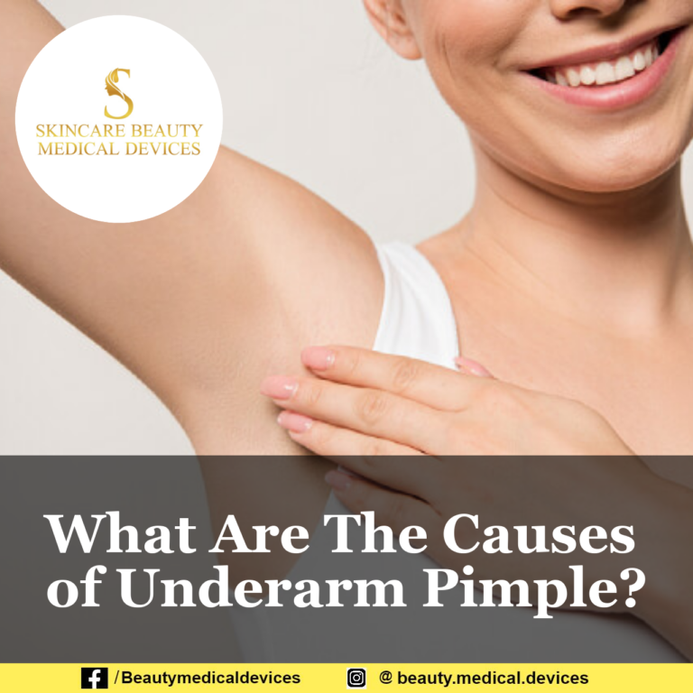 What Are The Causes of Underarm Pimple?
