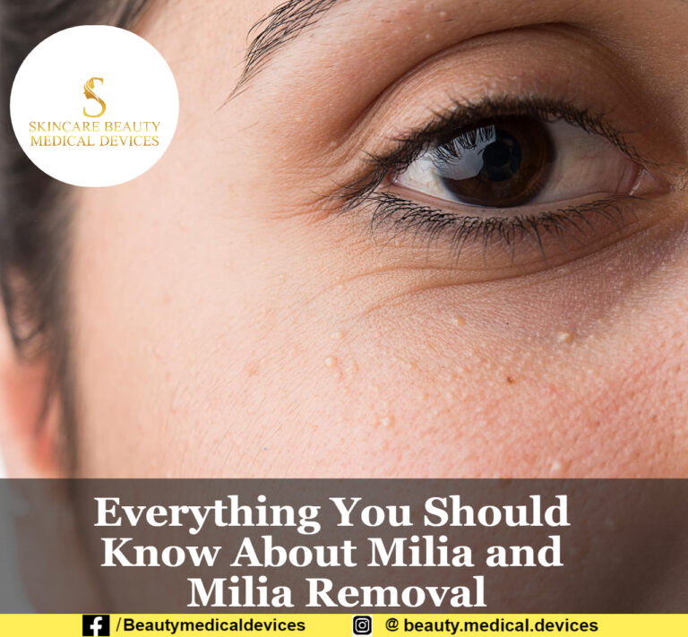 Everything You Should Know About Milia and Milia Removal