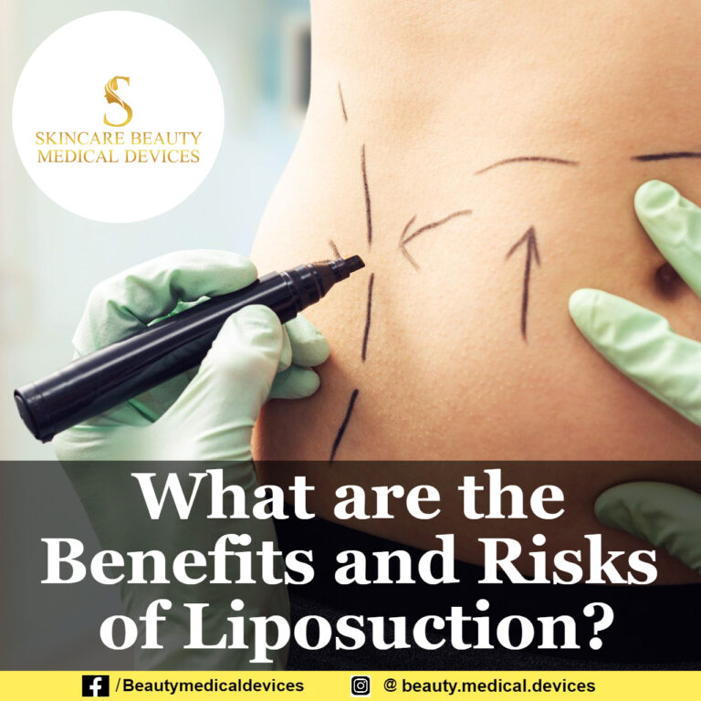 What are the Benefits and Risks of Liposuction?