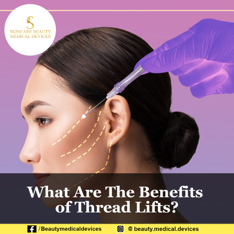 What Are The Benefits of Thread Lifts?