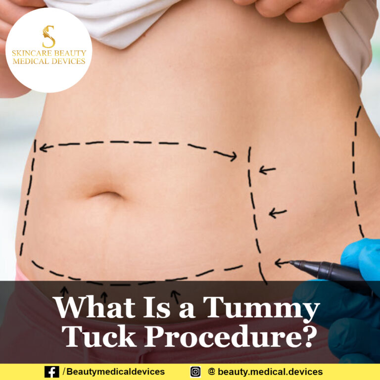 What Is a Tummy Tuck Procedure?