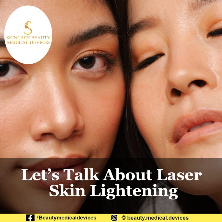 Let’s Talk About Laser Skin Lightening
