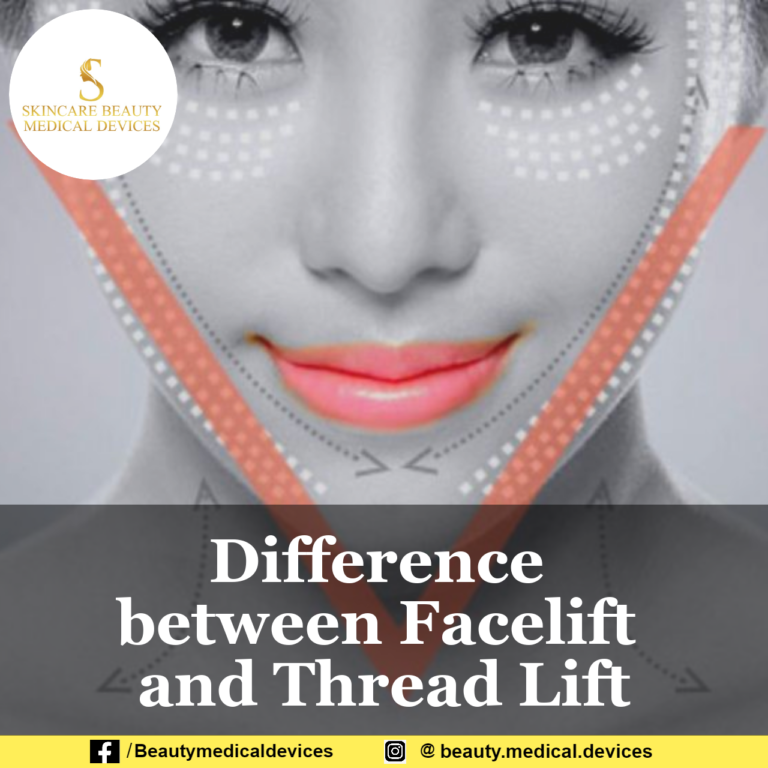 Difference Between Facelift and Thread Lift