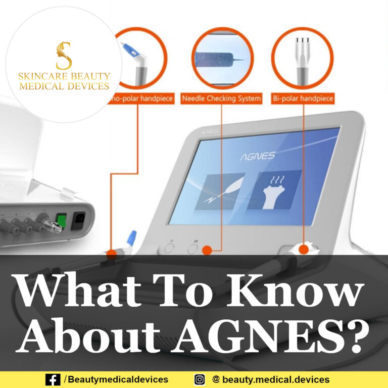 What To Know About AGNES?