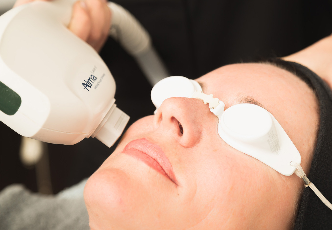 The 5 Most Effective Laser Treatments for the Face and How They Will
