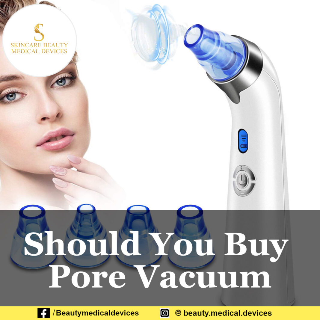 Should You Buy Pore Vacuum
