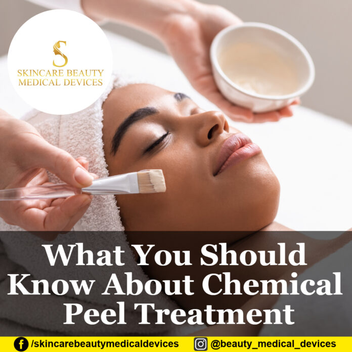 What You Should Know About Chemical Peel Treatment