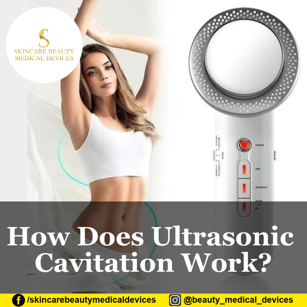 How Does Ultrasonic Cavitation Work?