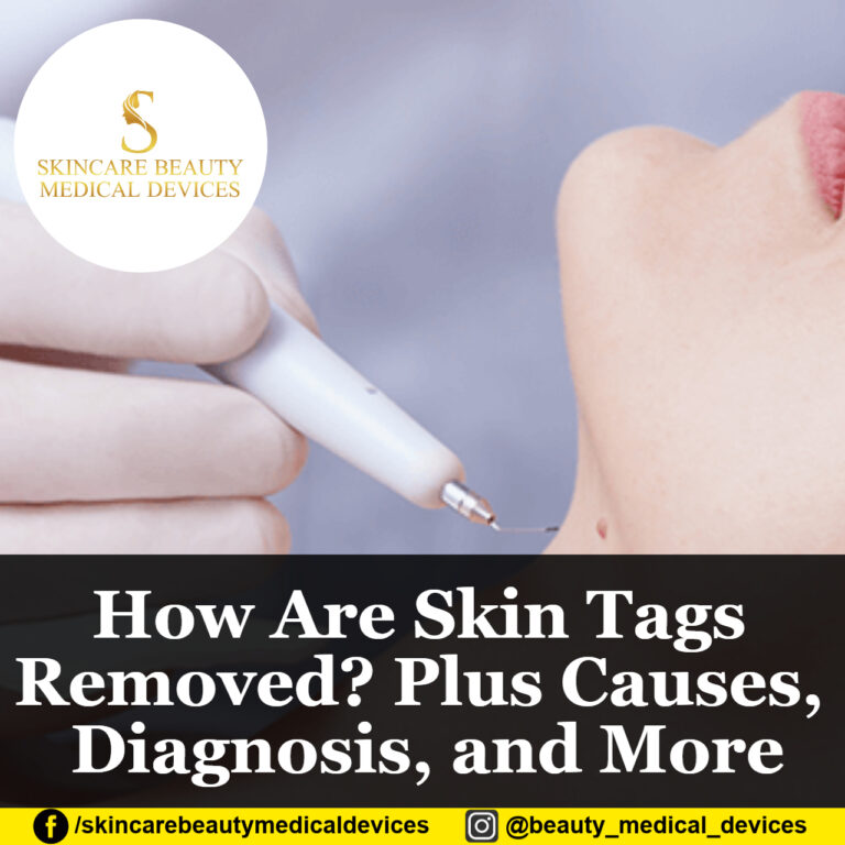 How Are Skin Tags Removed? Plus Causes, Diagnosis, and More