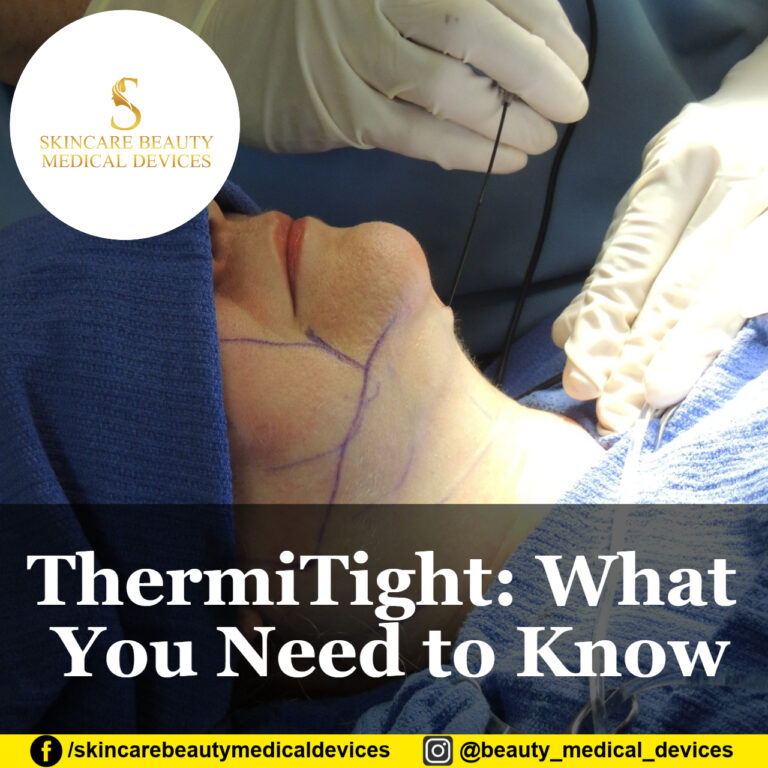 ThermiTight: What You Need to Know