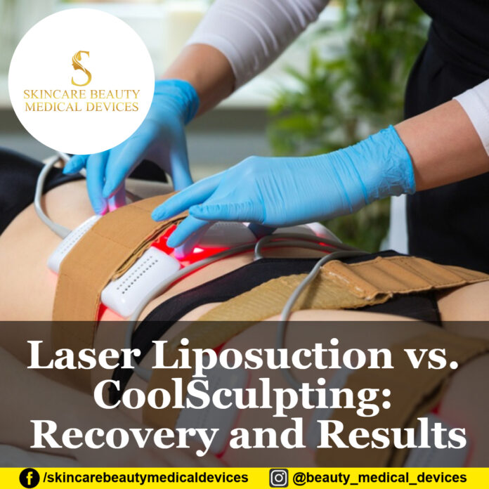 Laser Liposuction vs. CoolSculpting Recovery and Results