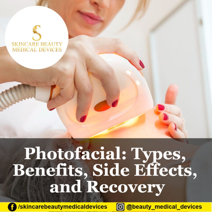 Photofacial: Types, Benefits, Side Effects, and Recovery