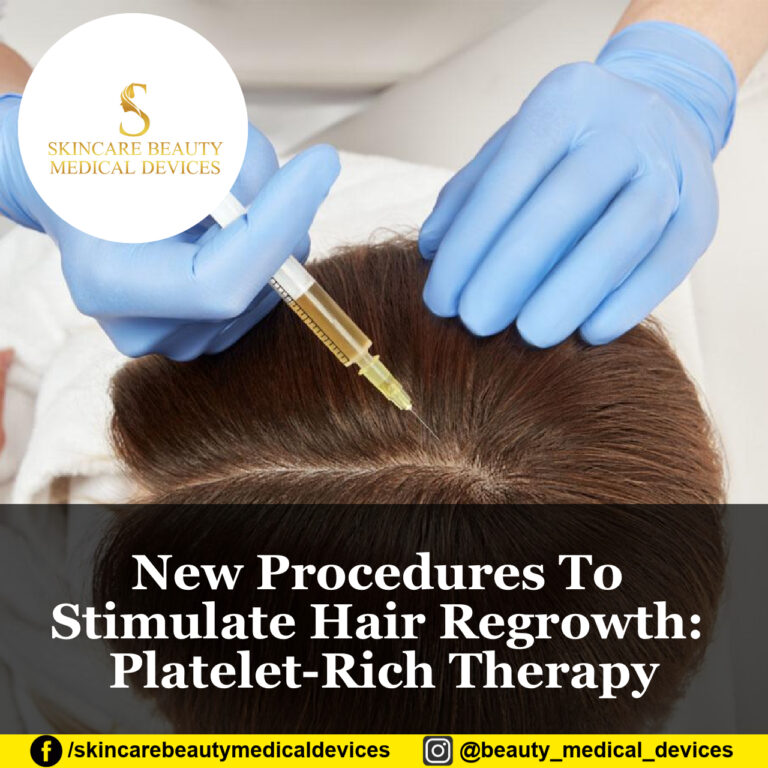 New Procedures To Stimulate Hair Regrowth: Platelet-Rich Therapy