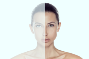 What Procedures Are Prescribed For Facial Asymmetry Correction?