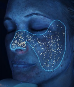 What Are Skin Porphyrins And How To See Them?