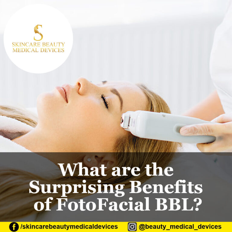What are the Surprising Benefits of FotoFacial BBL?