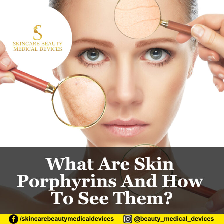 What Are Skin Porphyrins And How To See Them?