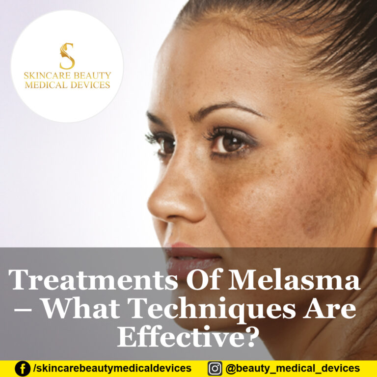 Treatments Of Melasma – What Techniques Are Effective?
