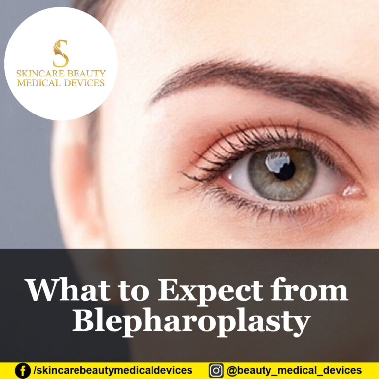 What to Expect from Blepharoplasty