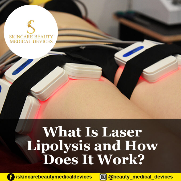 What Is Laser Lipolysis and How Does It Work?