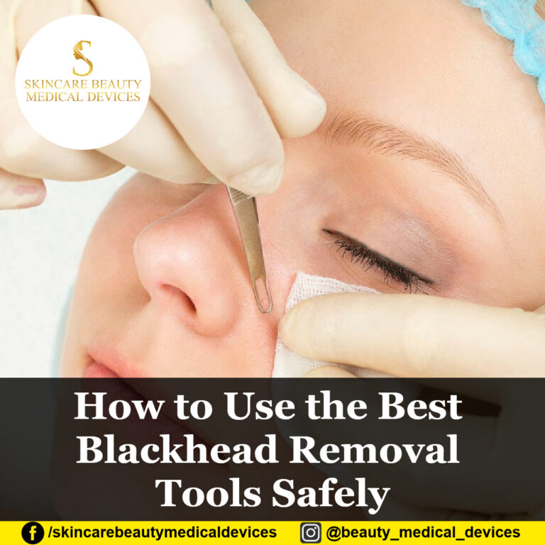 How to Use the Best Blackhead Removal Tools Safely