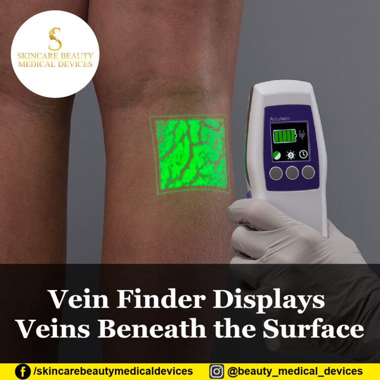 Vein Finder Displays Veins Beneath the Surface