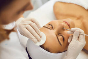 How to safely remove blackheads