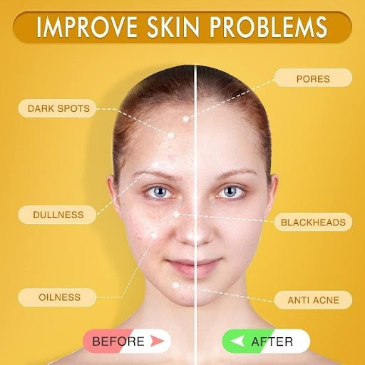 Two Home Remedies For Clear Glowing Skin!