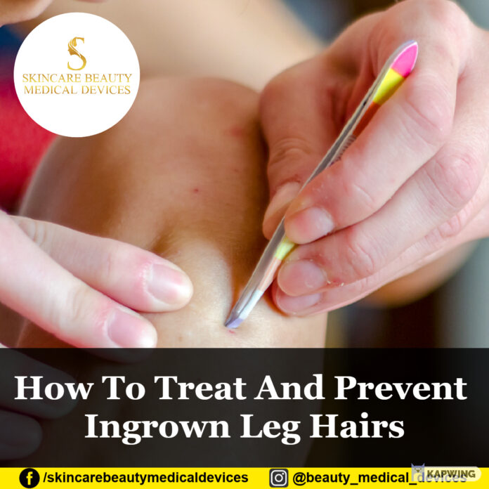 How To Treat And Prevent Ingrown Leg Hairs