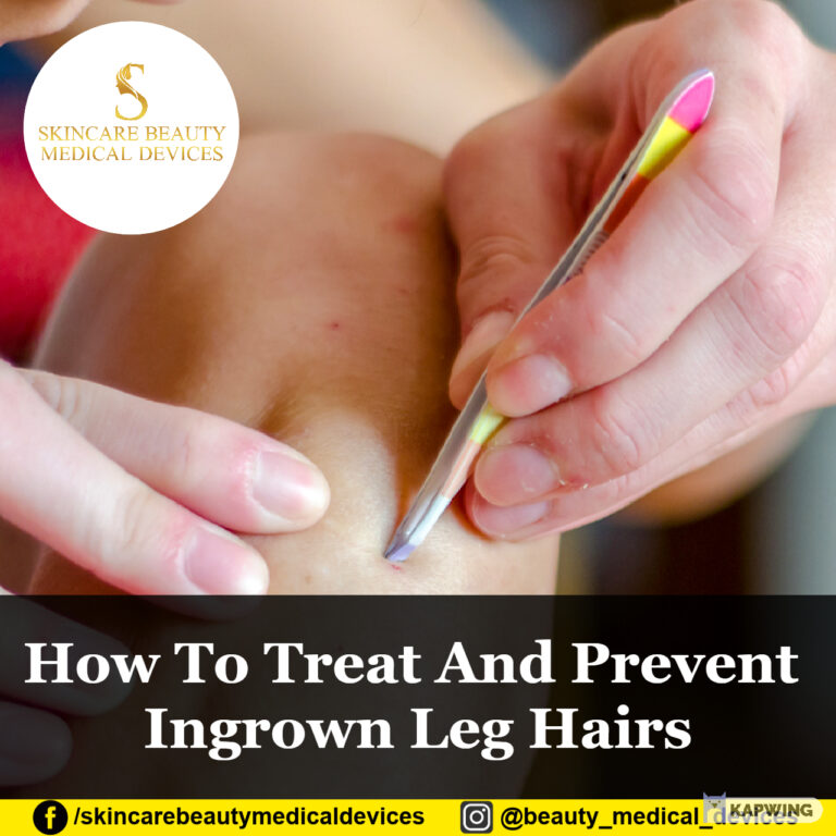 How To Treat And Prevent Ingrown Leg Hairs