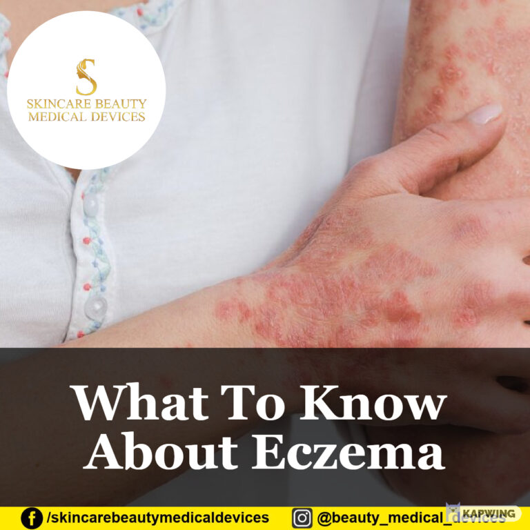 What To Know About Eczema