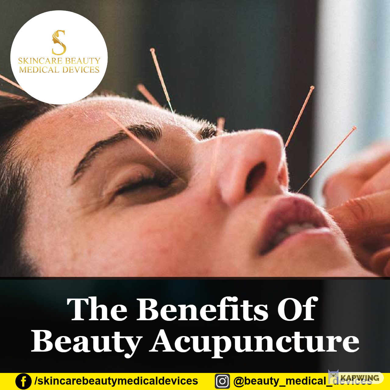 The Benefits Of Beauty Acupuncture