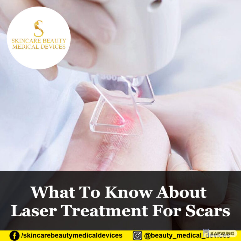 What To Know About Laser Treatment For Scars