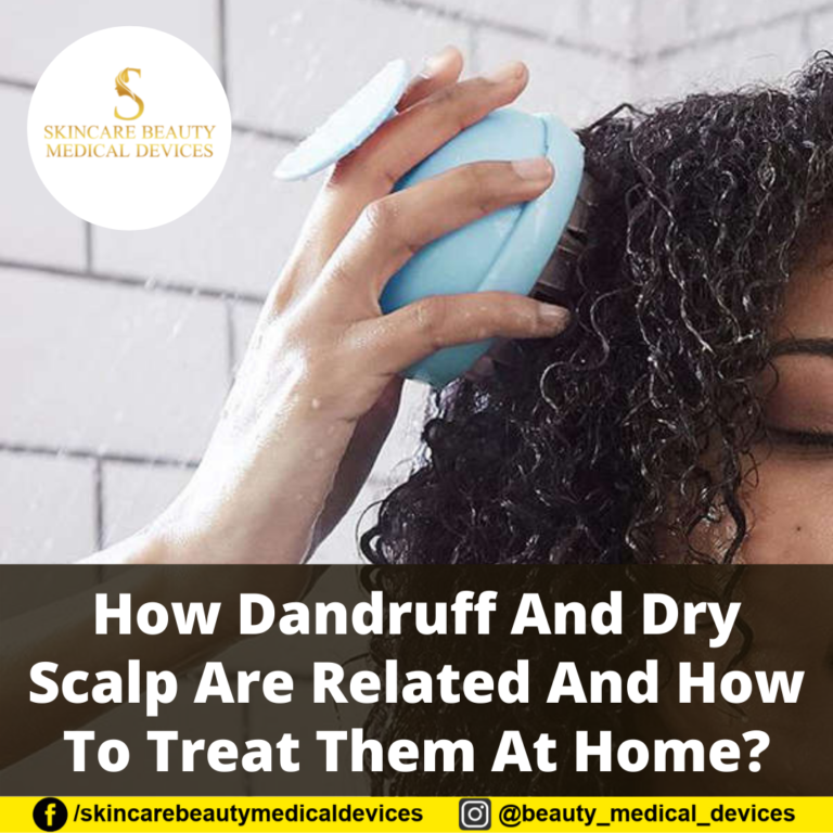 How Dandruff And Dry Scalp Are Related And How To Treat Them At Home?