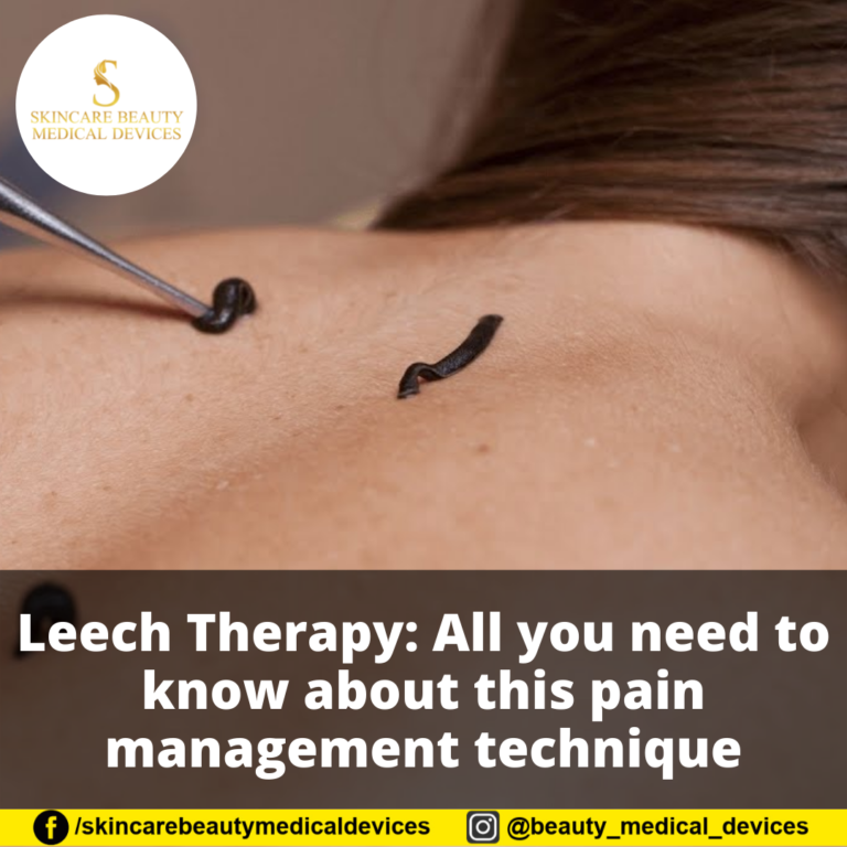 Leech Therapy: All you need to know about this pain management technique