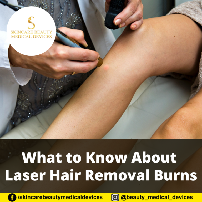 What to Know About Laser Hair Removal Burns