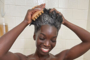 How Dandruff And Dry Scalp Are Related And How To Treat Them At Home?