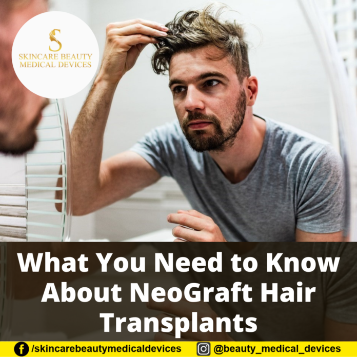 What You Need to Know About NeoGraft Hair Transplants