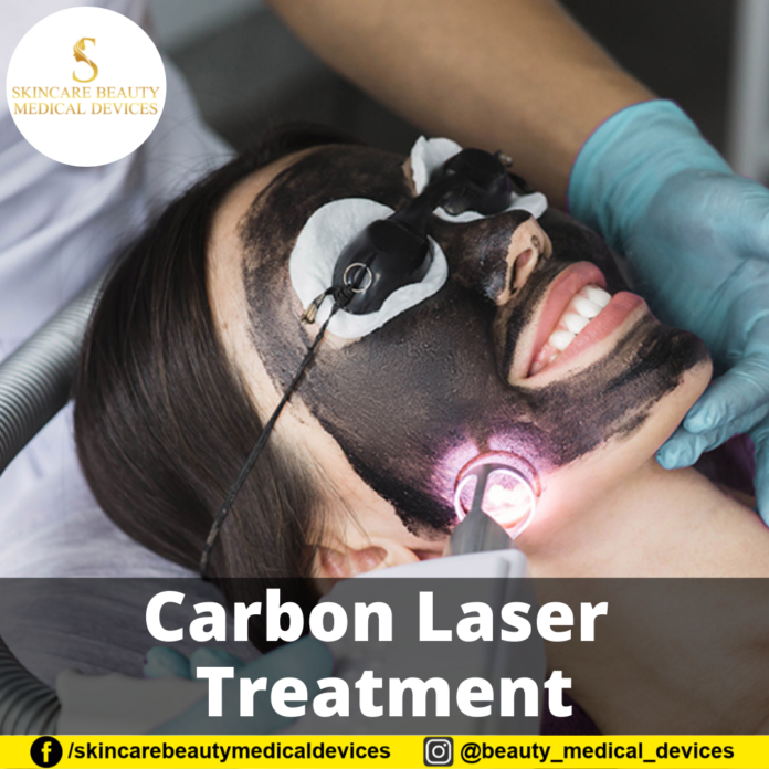 Carbon Laser Treatment Carbon Laser Treatment