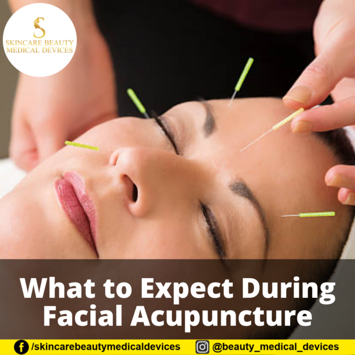 What to Expect During Facial Acupuncture