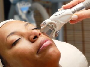 Dermatologists Explain the Best Laser Treatments for Dark Skin Tones